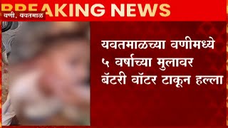 Yavatmal : पाच वर्षाच्या चिमुकल्यावर अॅसिड सदृश हल्ला, सलग तिसऱ्या हल्ल्यानं नागरिक चिंतेत