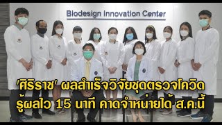 ‘ศิริราช’ เผยผลสำเร็จวิจัยชุดตรวจโควิด รู้ผลไว 15 นาที คาดจำหน่ายได้ ส.ค.นี้