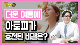 여름에 취약한 아토피? '이렇게' 관리하면 아토피가 치료됩니다! - 박치영의 피부 톡톡 #82