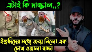 এটাই কি দাজ্জাল,,? ইহুদিদের মধ্যে জন্ম নিলো এক চোখ ওয়ালা বাচ্চা || Saif story