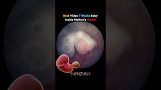 Real Video of 7 Weeks Baby in Mother's Womb 🥰💯 #pregnancy #fetus  #embryo