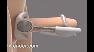ProExtender® Penis Extender   Penis Enlargement & Male Enlargement Device