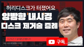 [ 부산양방향내시경 , 부산척추양방향내시경수술 ] 양방향 내시경을 이용해서 디스크를 제거한 증례입니다 (부산큰병원 우영하)