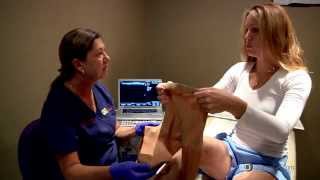 What conservative treatment options are used to treat varicose veins? - Dr. William Bowers, MD