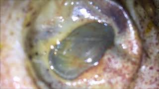 Bigfoot eyeball unveiling entire Head Soon. Frozen since 1953