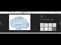 area 8 conjugate eye deviation