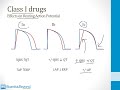 Cardiology Step 1  — Antiarrhtyhmic Drugs — Boards and Beyond