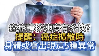 癌症轉移速度有多快？提醒：癌症擴散時，身體或會出現這5種異常