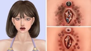 ASMR face maggots remove animation | ASMR face treatment animation
