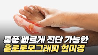 [핫클립] 통풍을 빠르게 진단할 수 있는 단초를 제공하다 / YTN 사이언스