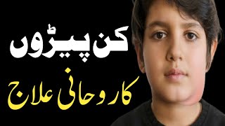 Mumps treatment in urdu | Kan paray ka ilaj | Kan pere ka ilaj in urdu