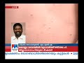 rare skin disease spreads in pathanamthitta discussion manorama news