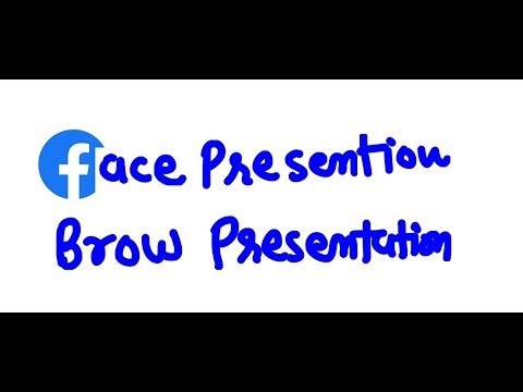 What causes brow presentation?