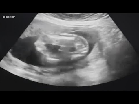 How does low birth weight affect infant mortality?