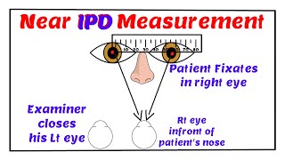 Near Inter Pupillary Distance Measurement.