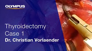 Total Thyroidectomy | THUNDERBEAT | Dr. Christian Vorlaender | Case 1