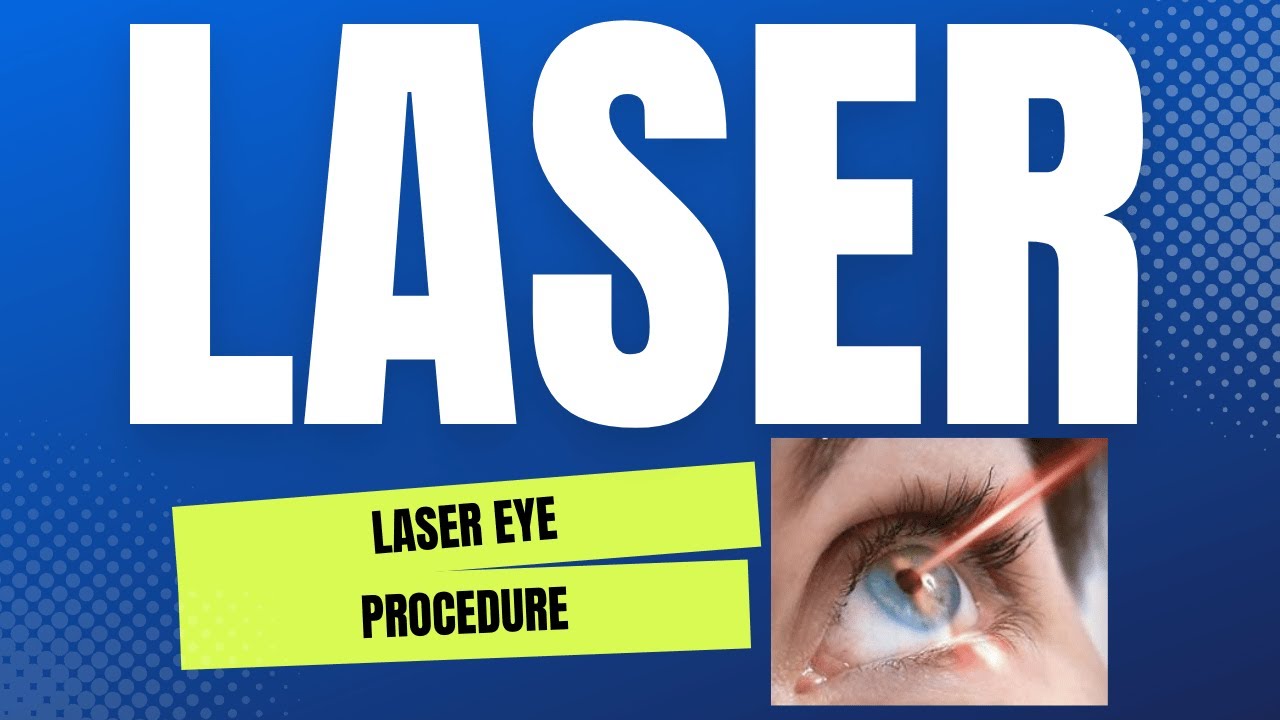 Laser Sa Mata Laser Eye Procedure Youtube