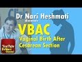 VBAC & TOLAC: Vaginal Birth After Cesarean Section Discussed by Dr Nari Heshmati