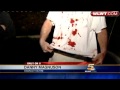 Man Attacked By Angry Mob At Apartment Complex