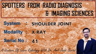 SPOTTERS FROM RADIO DIAGNOSIS (X-RAY SHOULDER JOINT- 41) - BY DR . ANIL JOSHI(PROFESSOR- RADIOLOGY).