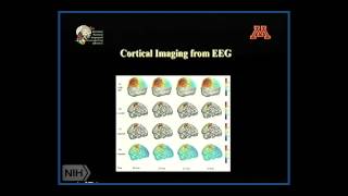 Adding fMRI to EEG