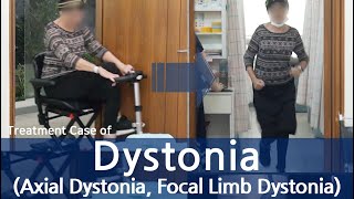 Dystonia / Axial Dystonia / Focal Limb Dystonia / 사경증 치료사례 / 근긴장이상증