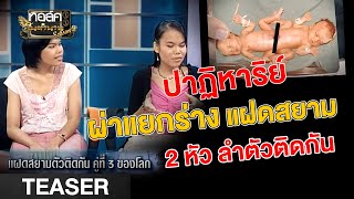 ทิวา - ราตรี แฝดสยาม คู่ที่ 3 ของโลก! | Talk ในตำนาน SS.3 | ออกอากาศ 4 ต.ค. | Talk ในตำนาน TEASER