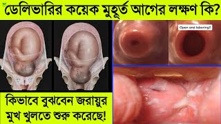 ডেলিভারির আগে জরায়ুর মুখ খোলার লক্ষণ কি কি? || বাচ্চা হওয়ার কিছুক্ষণ আগে কি লক্ষণ প্রকাশ পায়? দেখুন!