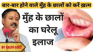 मुंह के छालो का घरेलू उपचार | मुँह में छाले कैसे ठीक करें | Remedies for Mouth Ulcers By Rajiv Dixit