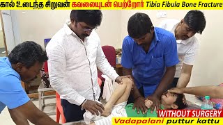 Puttur kattu Bonesetting Tradional Treatment in tamil கால் உடைந்த சிறுவன் Dr.R.S.Velumani