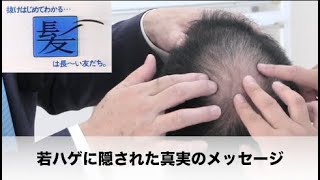 【必見】若ハゲに隠された感動のメッセージ（ダイジェスト）