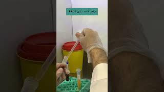 مراحل آماده سازی PRGF