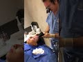 FaceTite Scarless Browlift