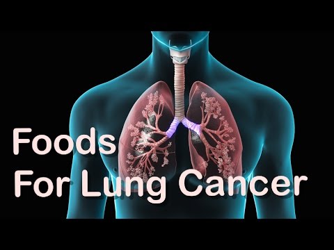 15 Foods That Helps To Fight With Lung Cancer Naturally 15 Foods That Helps To Fight With Lung Cancer Naturally