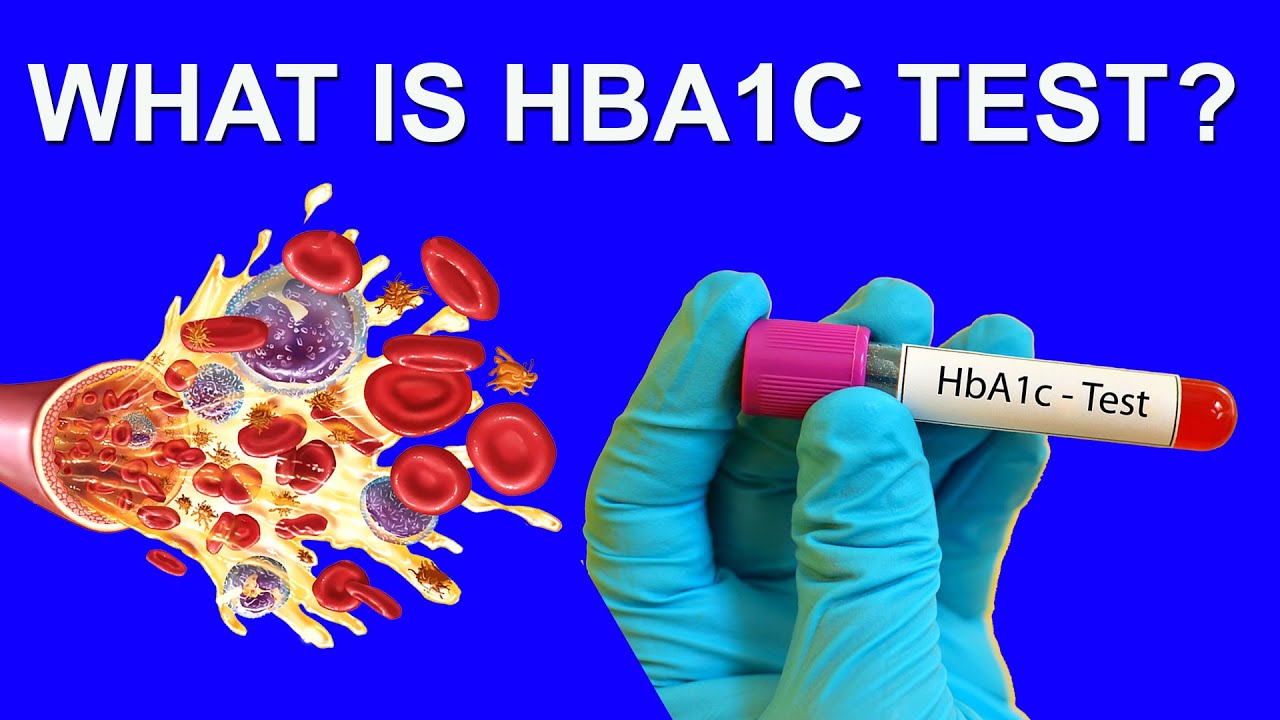 What Is HbA1c Test: What You Need To Know - YouTube