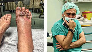 Couple Noticed Their Feet After Walk On Beach, Doctors Refused To Help