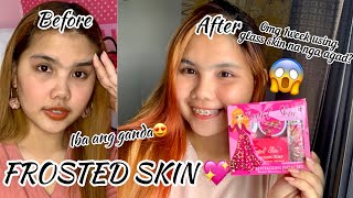 1WEEK TRYING FROSTED SKIN REVITALIZING ( sobrang ganda ) || ALEXIES QUENDAN