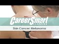 Skin Cancer: Melanoma