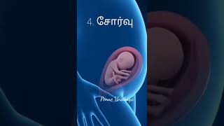 இந்த 8 அறிகுறிகள் இருக்கா?கர்ப்பம் உறுதி 🤰🏻👍🏻 #pregnancytips #pregnany #earlypregnancysymptoms