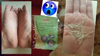 Purederm Foot Peeling Mask Review