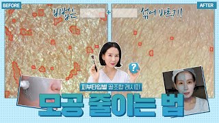 (*Eng) 모공 조이는 성분 2가지 조합만 기억하세요. 집에서 모공 줄이는 방법 by. 디렉터파이