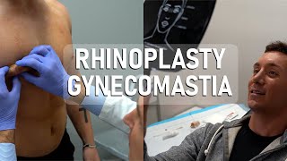 Rhinoplasty \u0026 Gynecomastia Surgery - Dr. Paul Ruff | West End Plastic Surgery