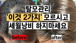 약사의 탈모 관리법 2가지ㅣ시간, 돈 아껴드립니다.ㅣ남성형탈모ㅣ탈모영양제ㅣ탈모관리ㅣ여성형탈모