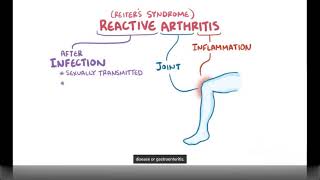 Reactive Arthritis - Causes, Symptoms, Diagnosis & Treatment (Pathology)
