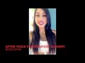 BEFORE & AFTER VOICE FEMINIZATION SURGERY