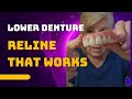 How To Get Your LOWER DENTURE To Fit Better