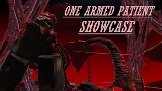 One Armed Patient Showcase | Original TDS RP