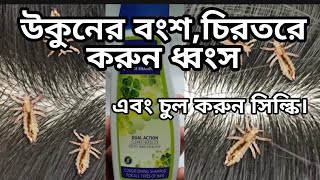 উকুনের বংশ করুন ধ্বংস-উকুন দূর করার সহজ উপায়- How to remove lice from hair | KHAN PHARMACY