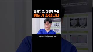 이렇게 치료하면 흉터가 더 안 좋아집니다