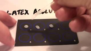 Latex Agglutination and Titer - Part 1